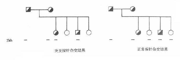 第二节 常见遗传性疾病的发生与基因诊断