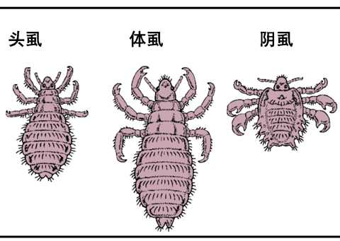 第203节 皮肤寄生虫感染