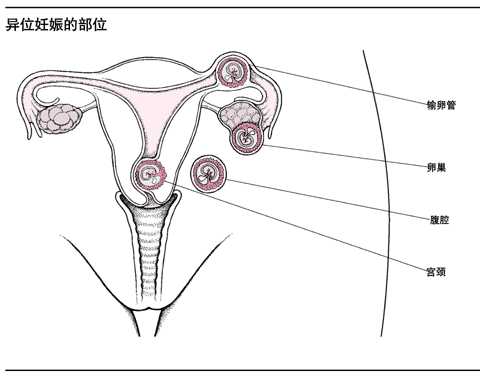 第245节 妊娠并发症