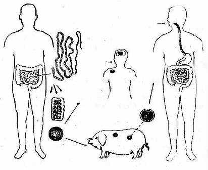 �г没��Teniasis��